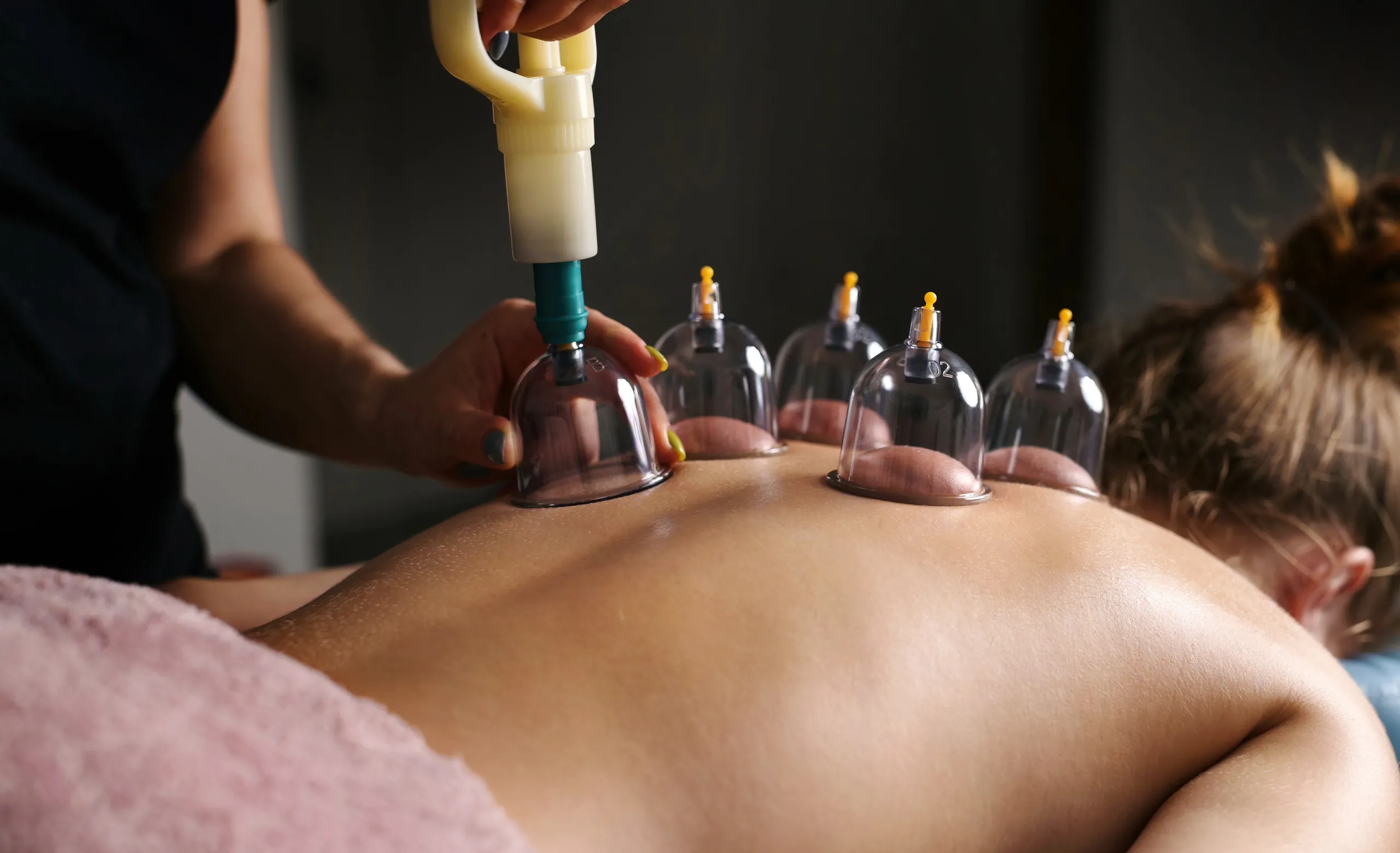 Schröpfmassage